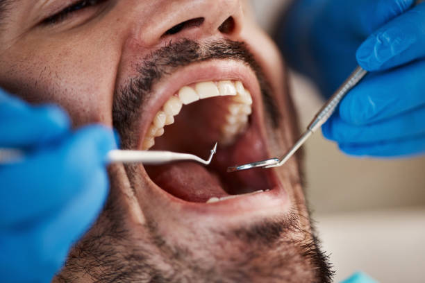 Best Emergency Tooth Extraction in Gardnertown, NY